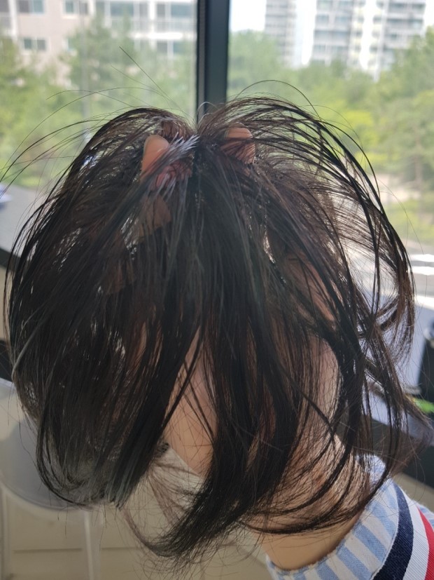 보톡스헤어 이미지