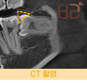 연세바른치과 이미지