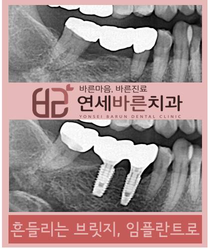 연세바른치과 이미지