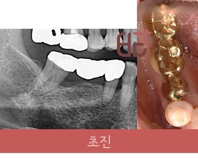 연세바른치과 이미지