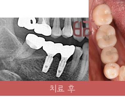 연세바른치과 이미지