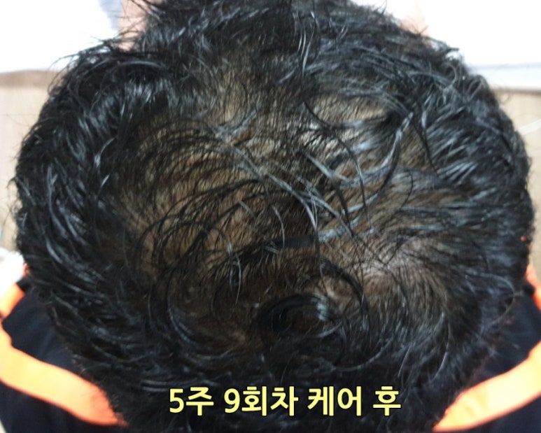 아위헤어 이미지