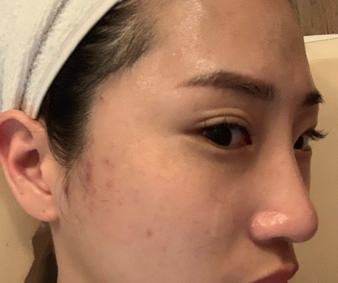 박수정청담뷰티센터인스티튜트 이미지