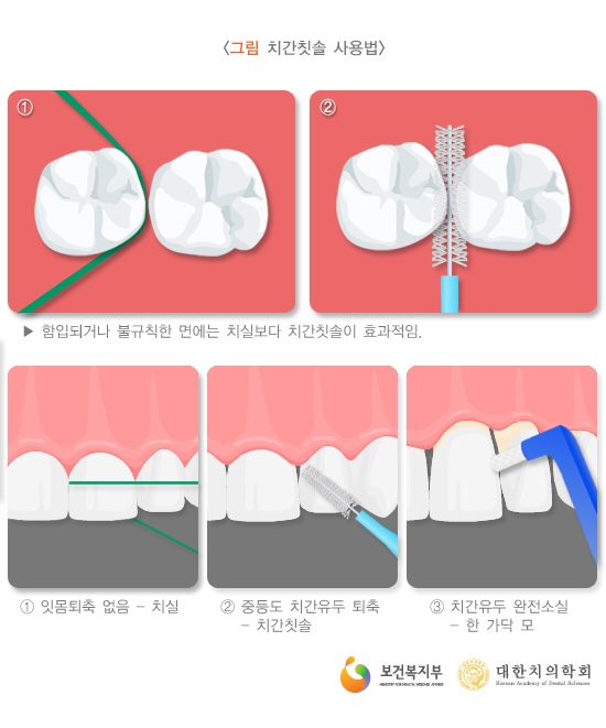 서울굿모닝치과 이미지