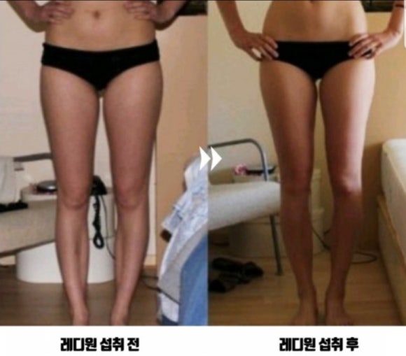 레디원 이미지