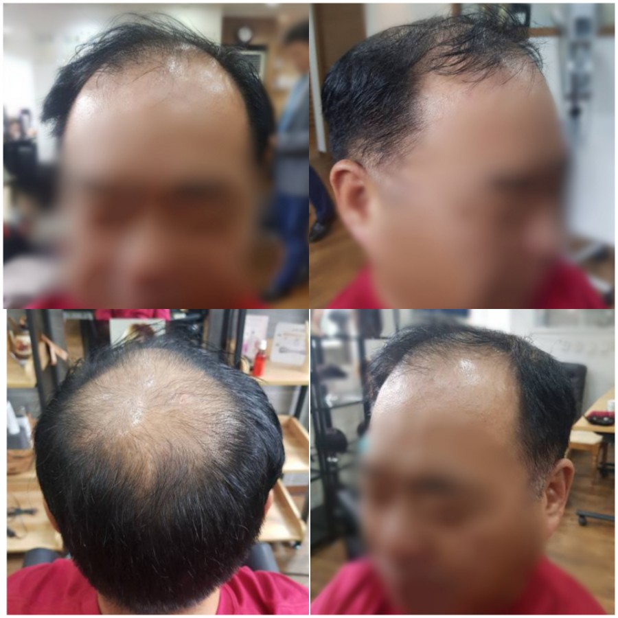 가발박사 이미지