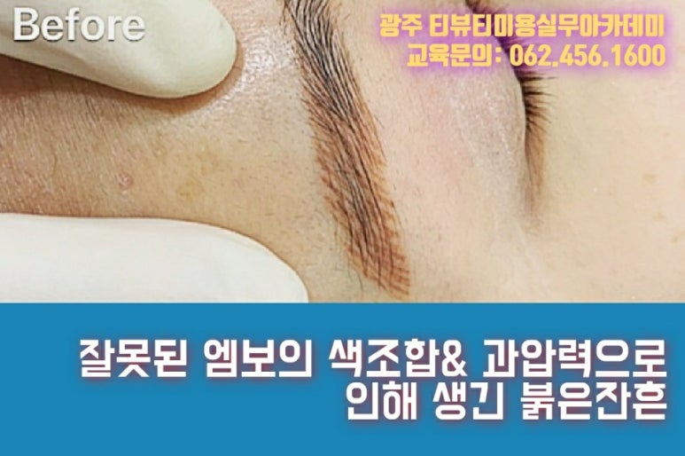 인셀덤 아카데미 이미지
