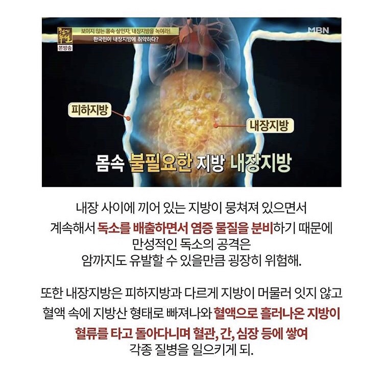 티그린 이미지