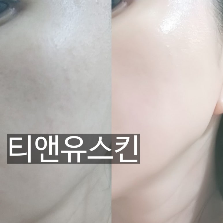 맑은 피부관리실 이미지