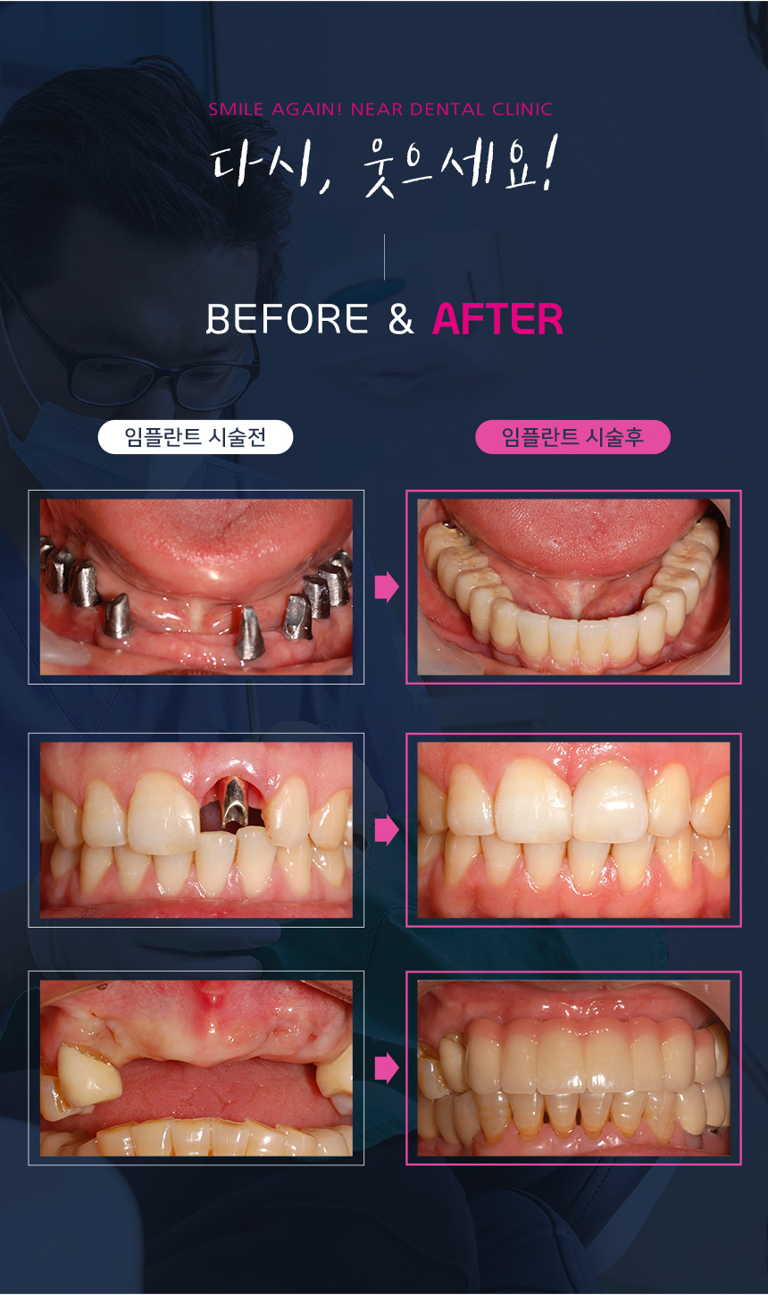 서울니어치과 이미지