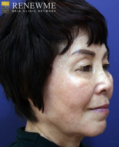 리뉴미피부과 이미지