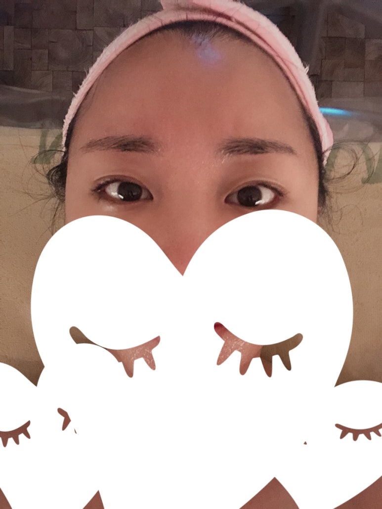 가림피부관리 이미지