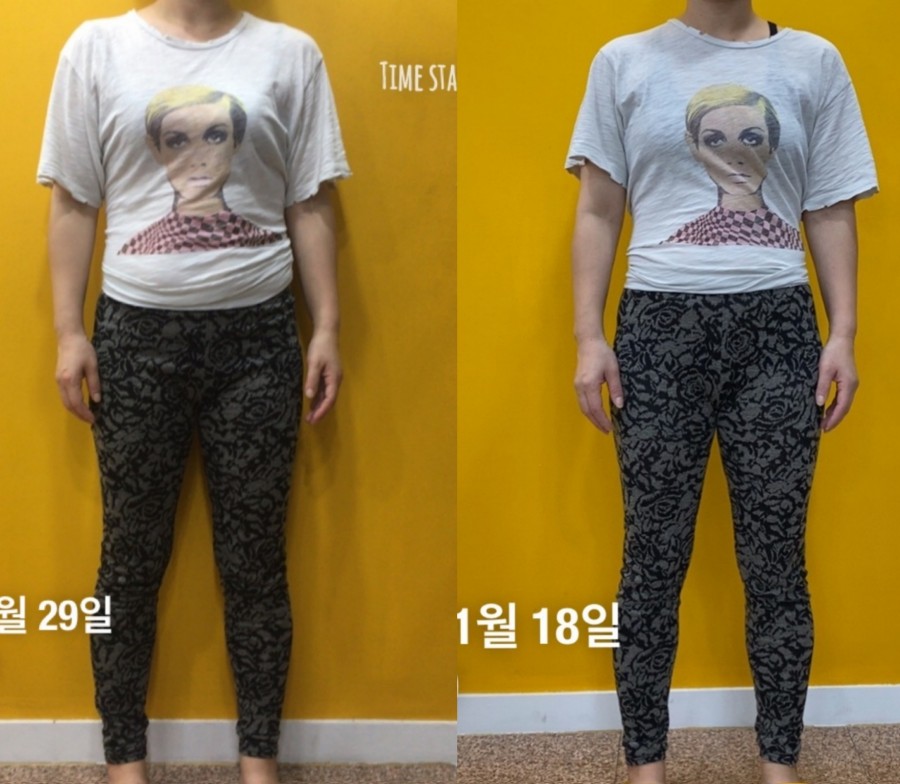 점핑스타트램플린운동 이미지