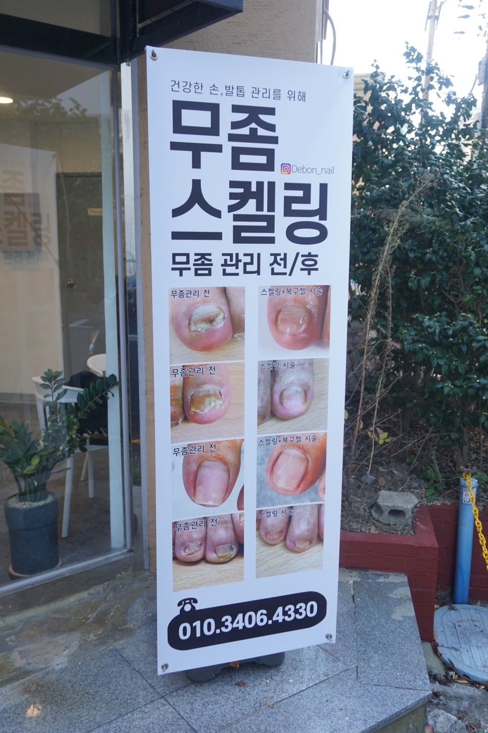 네일드본 이미지