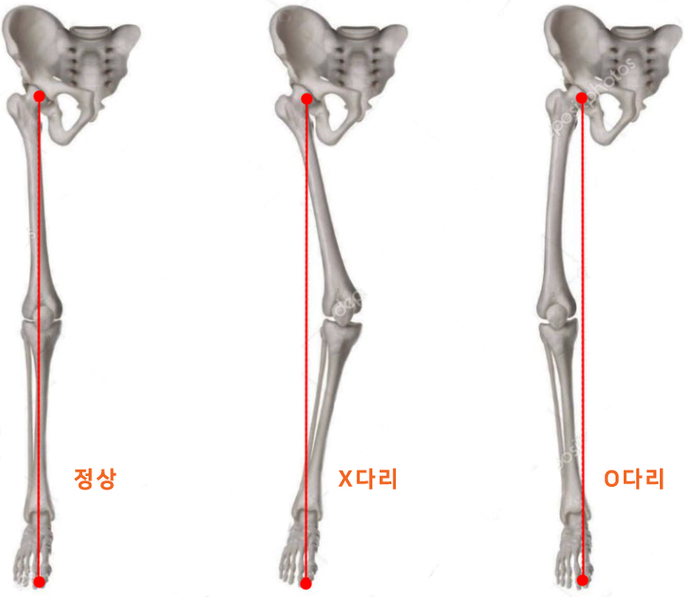 네추럴무브먼트 이미지