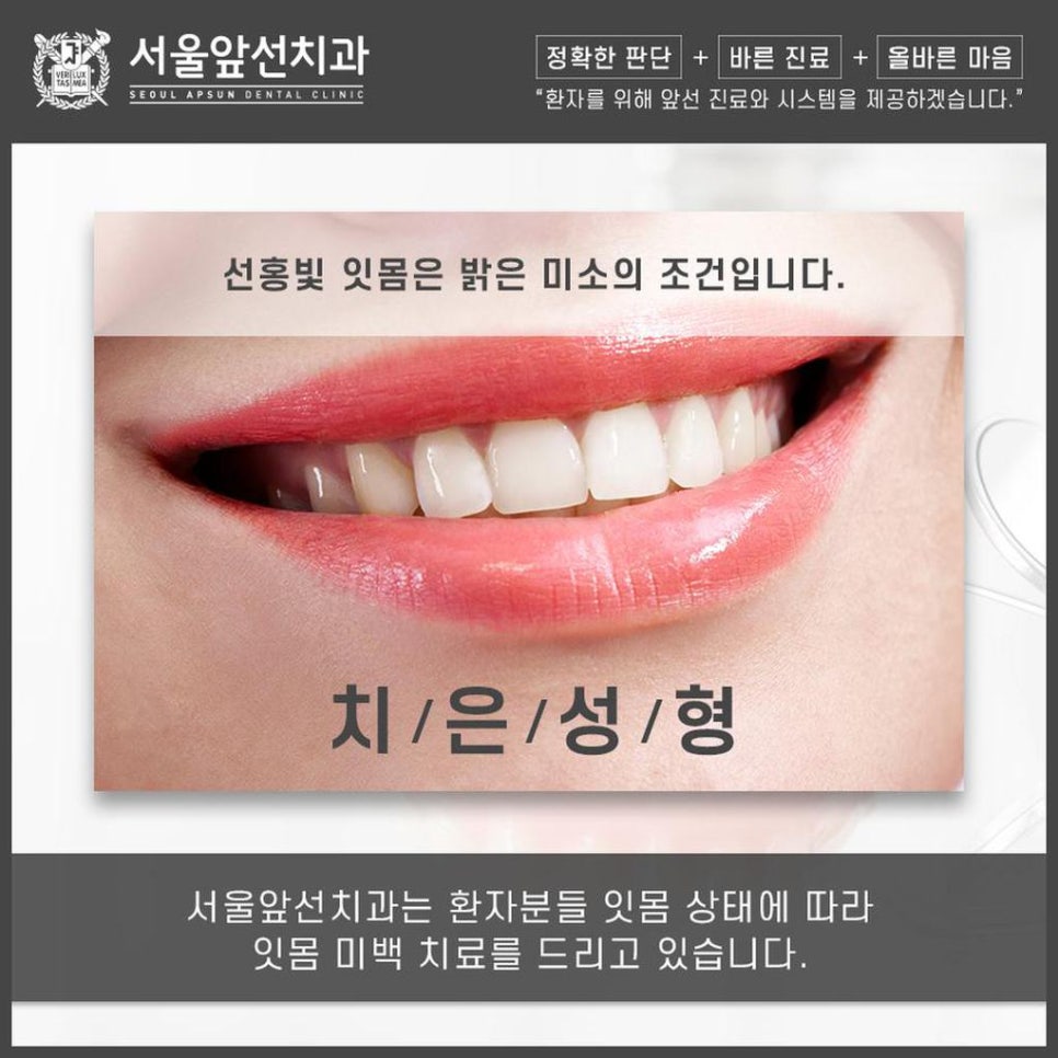 서울앞선치과 이미지