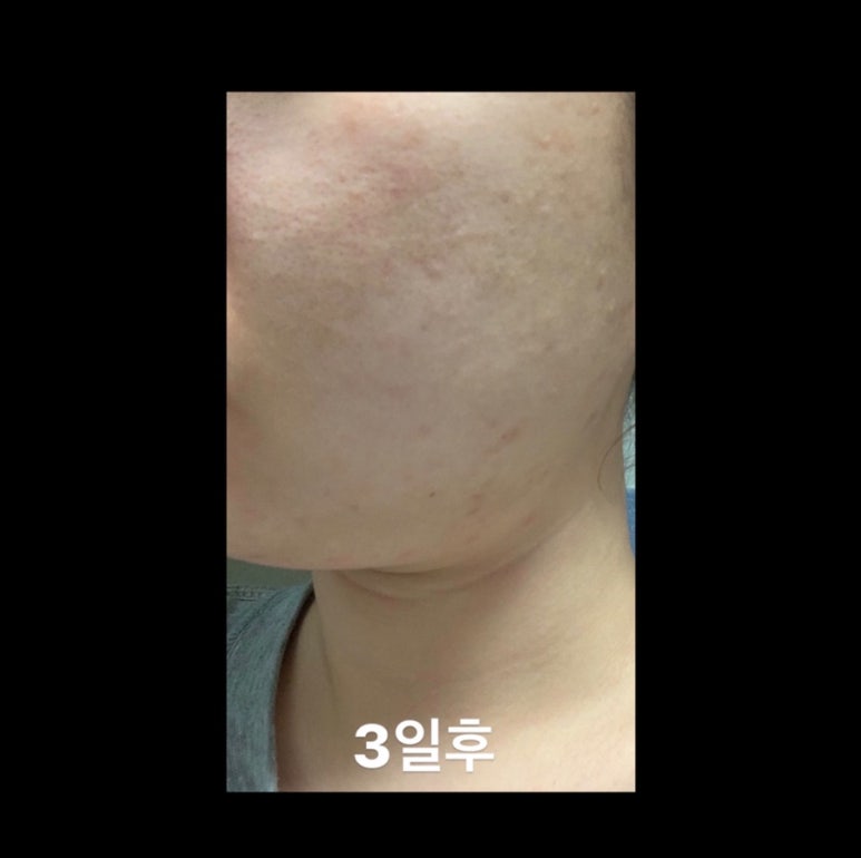 글로리어스뷰티 이미지
