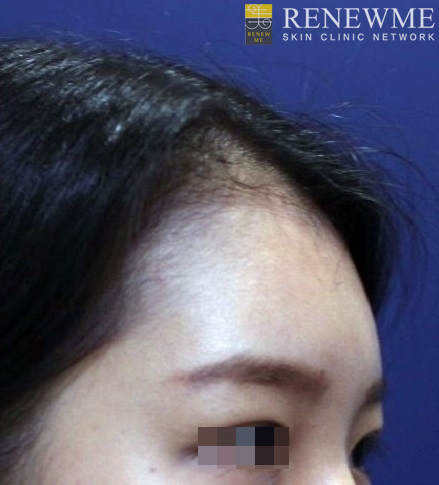 리뉴미피부과 이미지