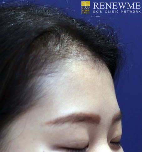 리뉴미피부과 이미지