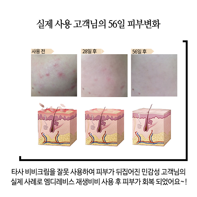 엠디광고 이미지