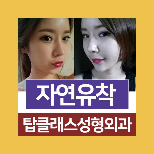 탑성형외과의원 이미지