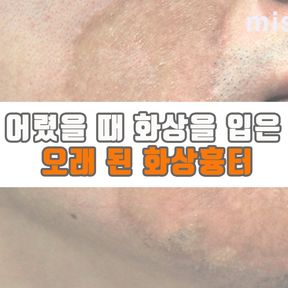 미소사랑의원 이미지