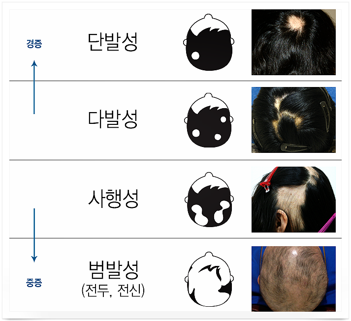 엠지에프두피탈모전문센터 이미지