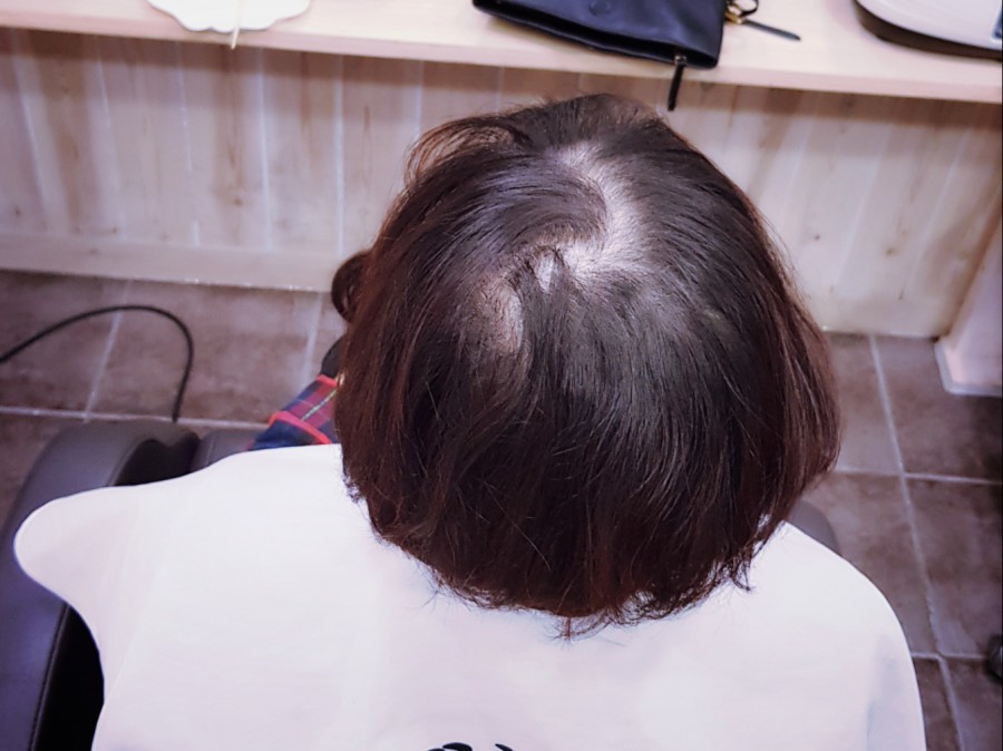 김호증모가발춘천체인점 이미지