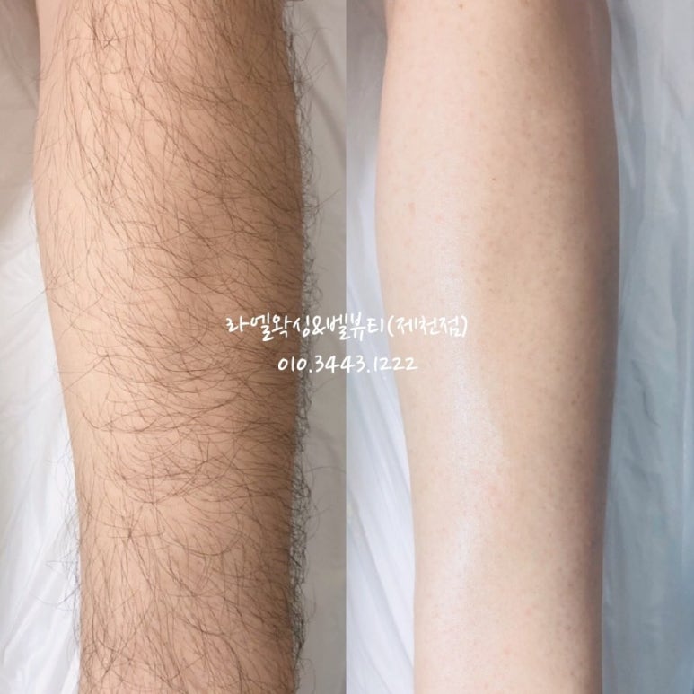라엘왁싱&벨 뷰티 이미지