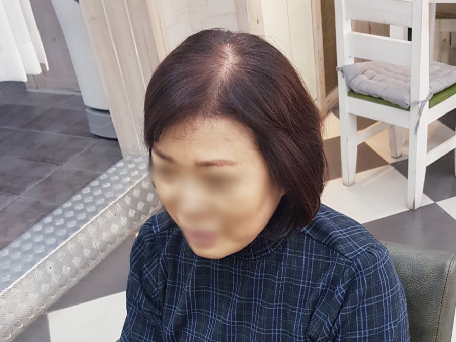 김호증모가발춘천체인점 이미지