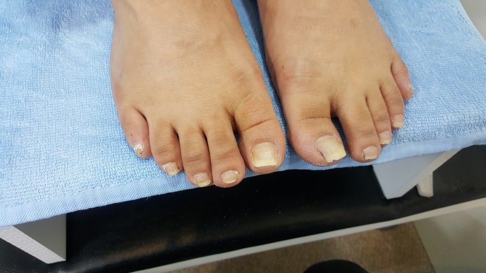 골드핑거네일 이미지