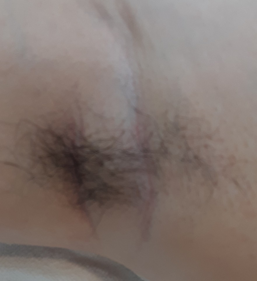 왁싱피플 이미지