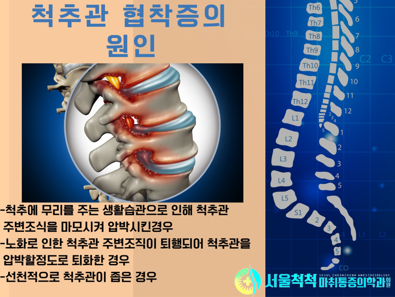 서울척척마취통증의학과 이미지