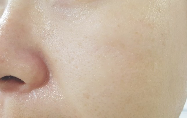 골드필 이미지