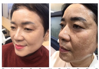 인셀덤서서울 이미지