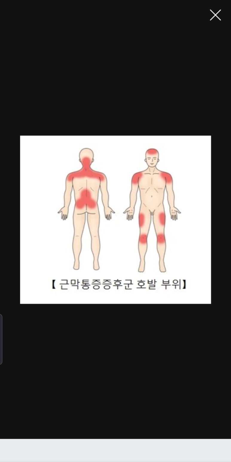 폭스짐 이미지