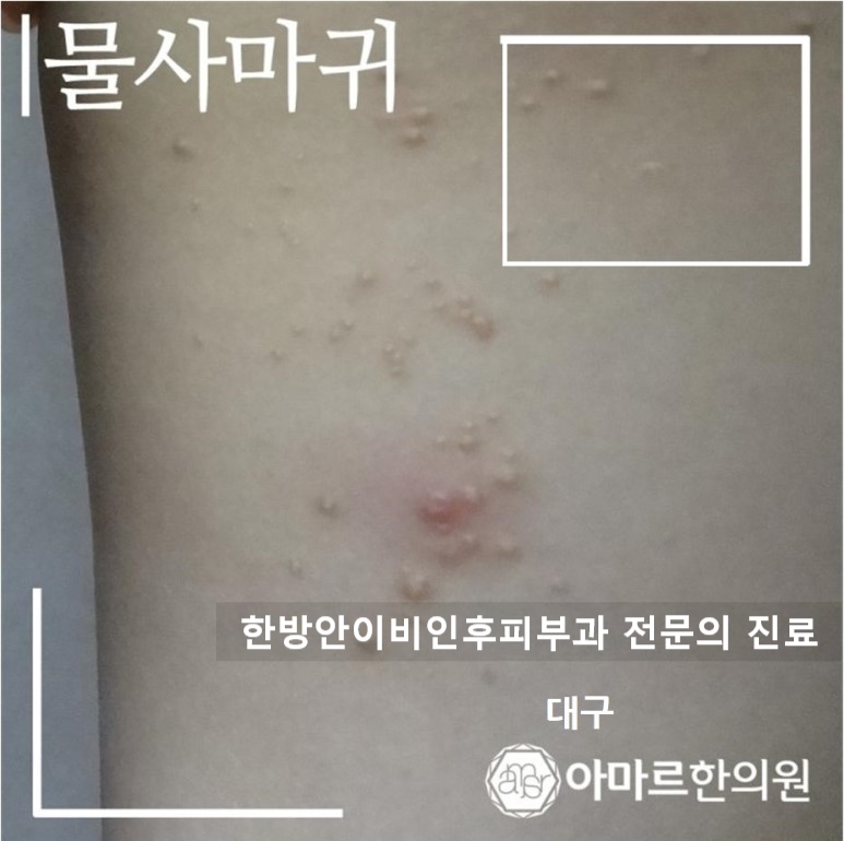 형제한의원 이미지