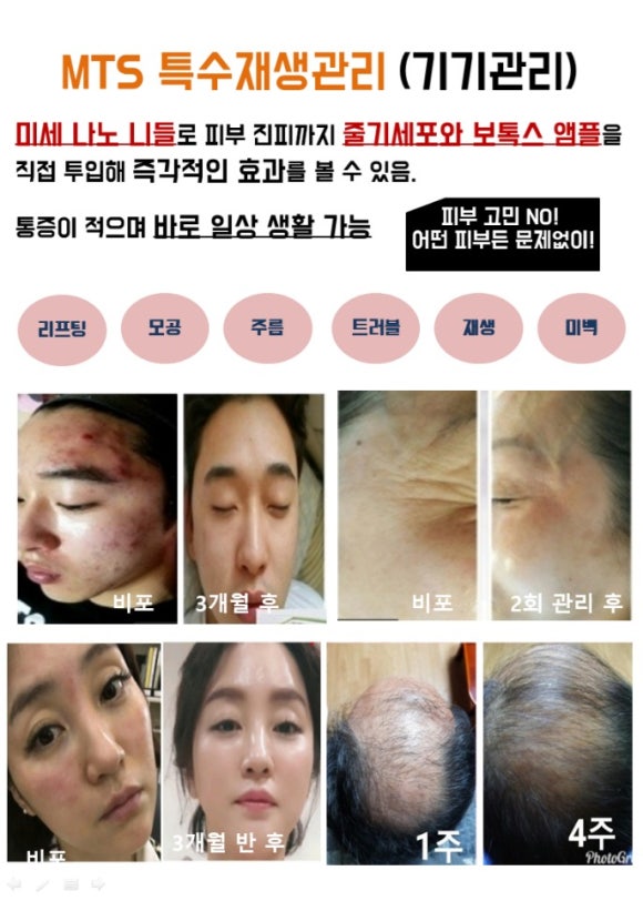 박지영 수정테라피 이미지
