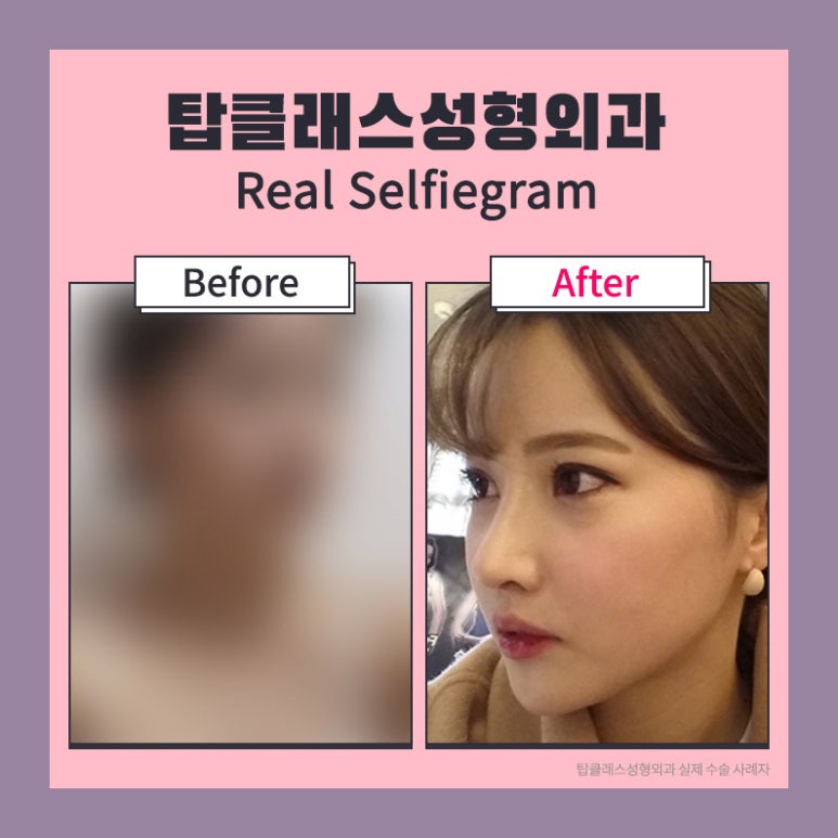 탑성형외과의원 이미지