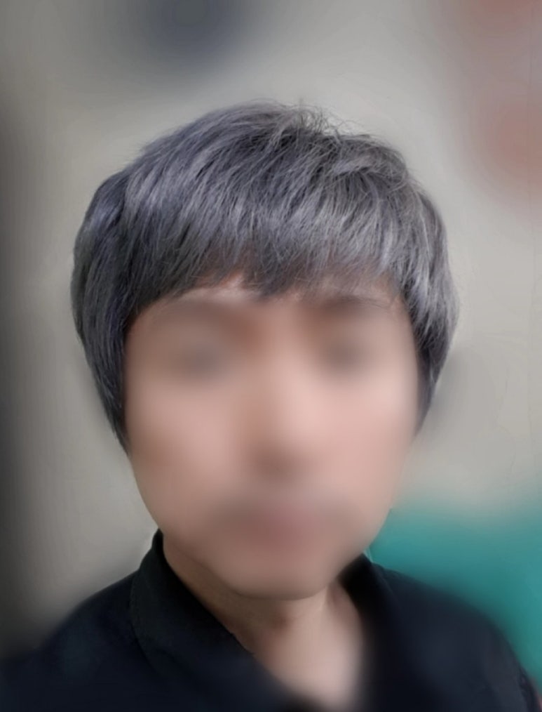 머리애 이미지