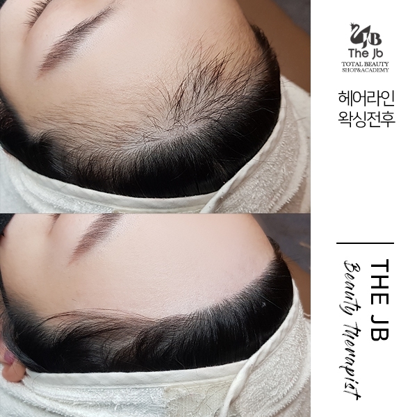 제이비라인 이미지