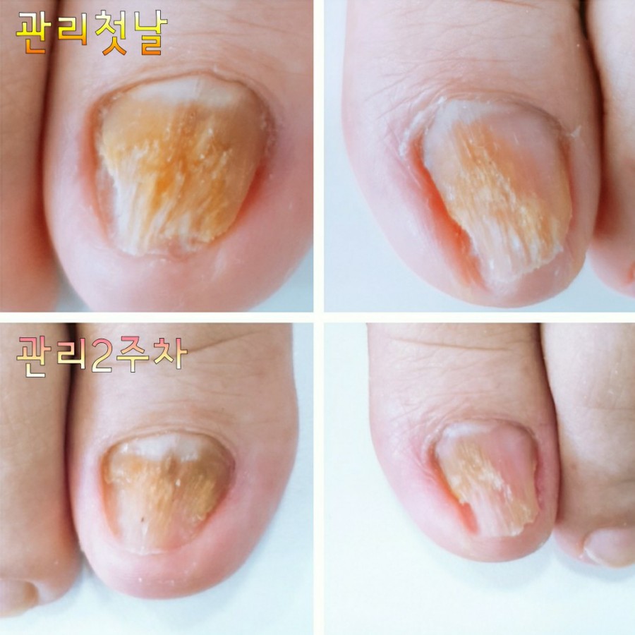 주u네일 이미지