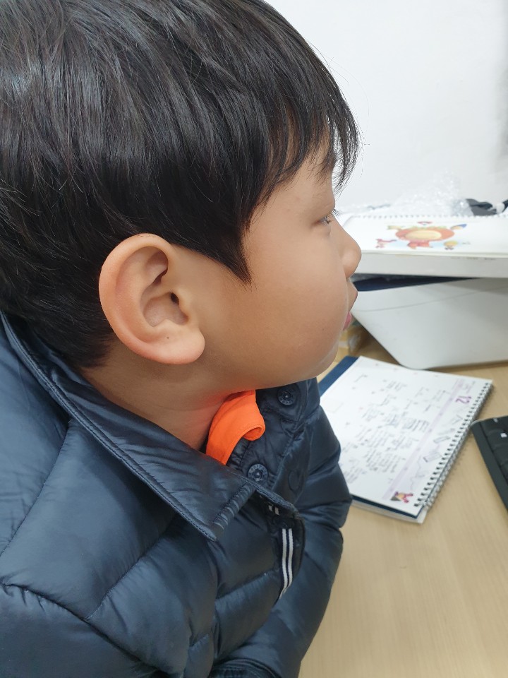 더마렉스 이미지