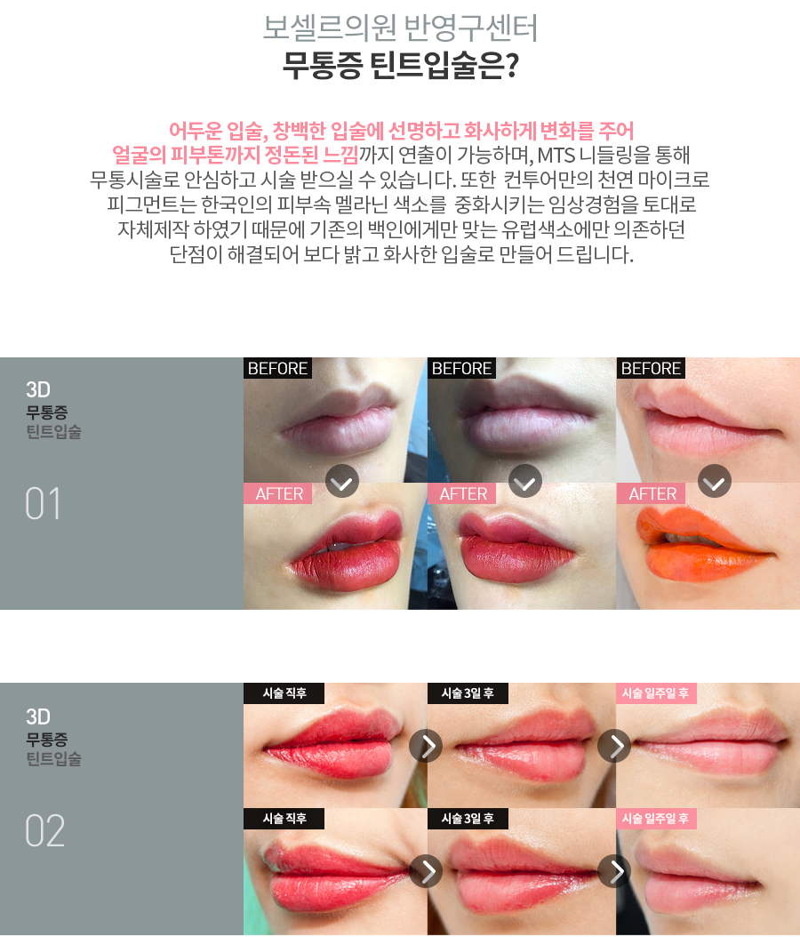 보셀르의원 이미지