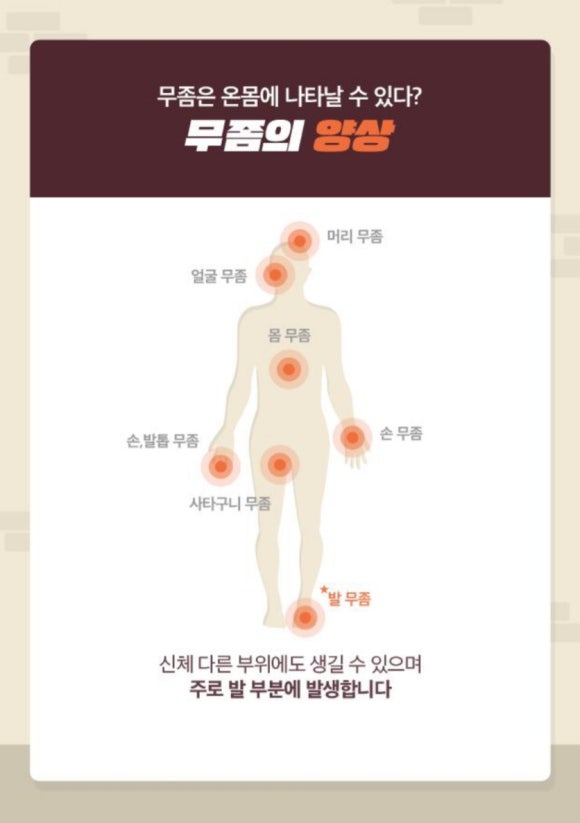 레푸스 이미지