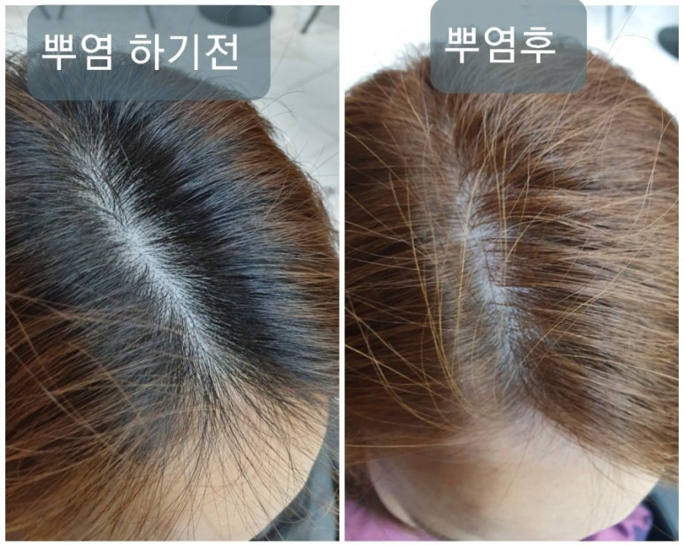 뽀끌레 이미지
