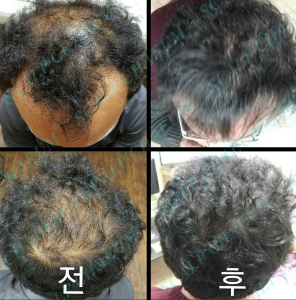 360헤어 이미지
