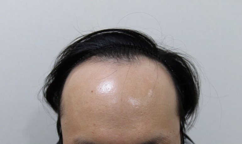 방지성에이스의원 이미지