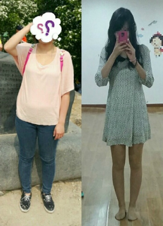 김*영 이미지