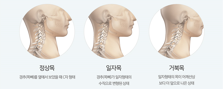 라인카이로프랙틱 이미지